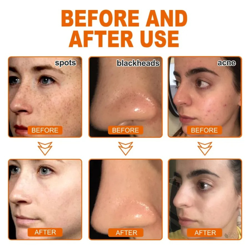 Herbal Peel-Off Mask – Dark Spot Remover & Skin Brightening